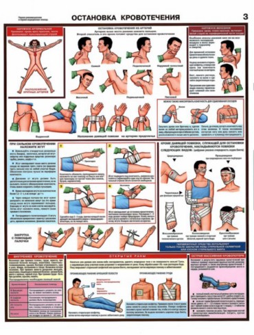 остановка кровотечения